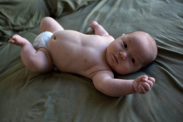 فتق اینگوینال در نوزادان و کودکان: راهنمای جامع برای تشخیص و درمان