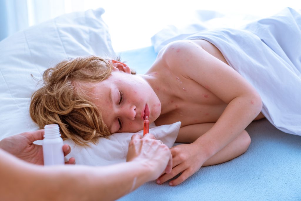 اِئوزینوفیلیک اُزو فیژیتیس (EoE) در کودکان: علائم، تشخیص و درمان